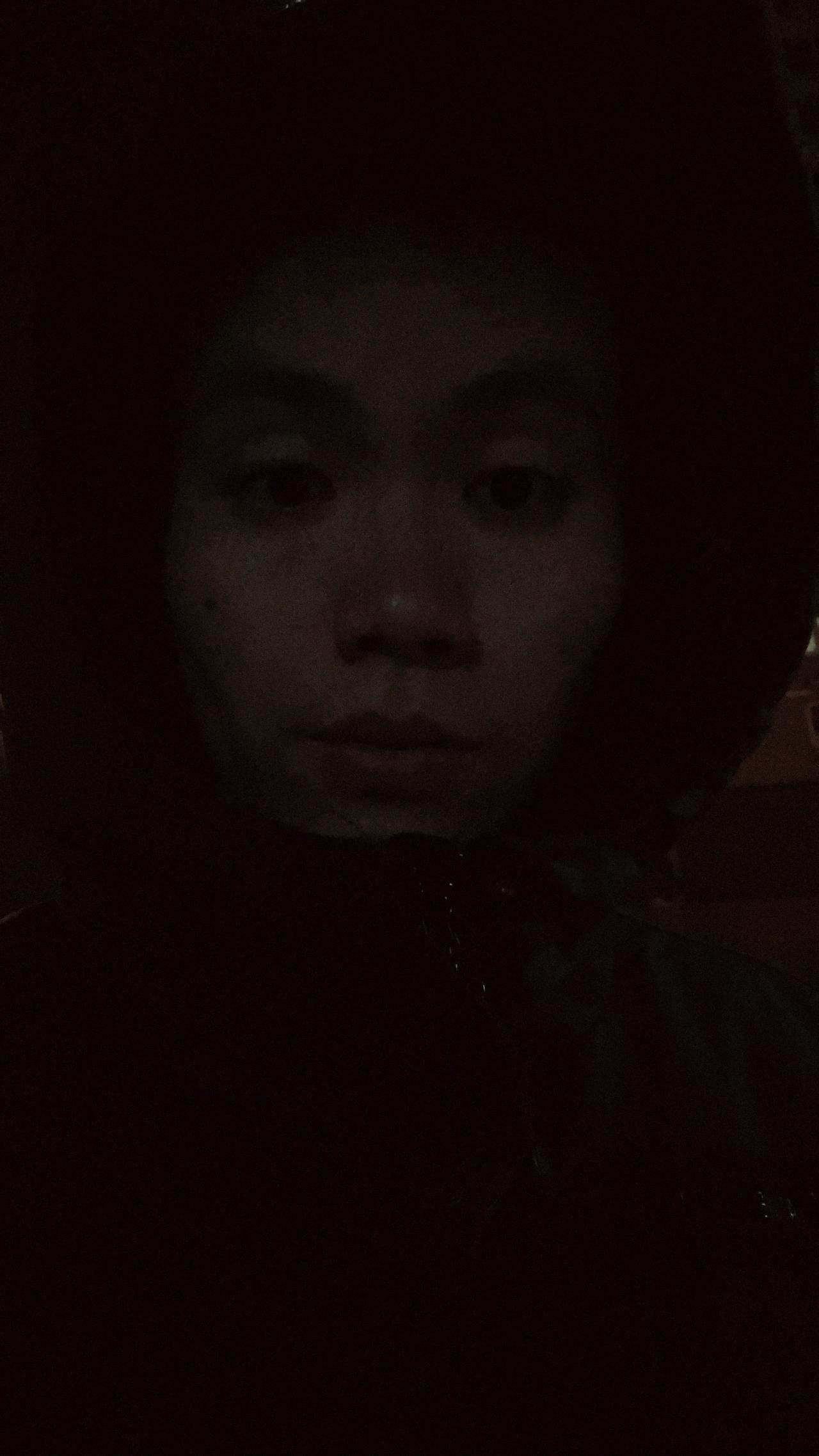 今天六台疝气手术非常顺利，下班了，北京天黑的真早，现在一片漆黑疝气治疗术 疝气局