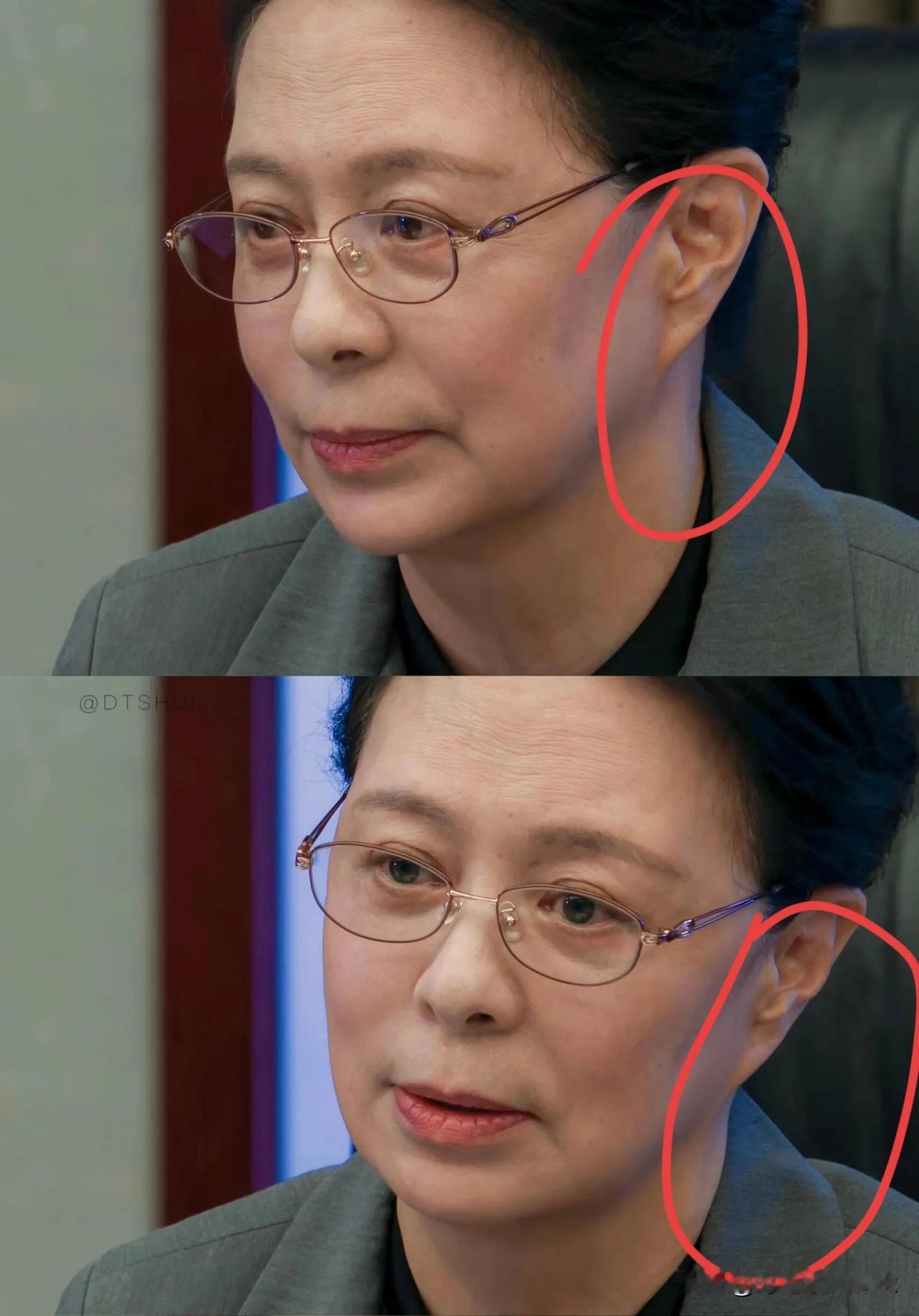 《以法之名》兰景铭这个耳朵是拉皮了吗？不太正常呀！[呲牙]

刚刚看剧发现兰书记