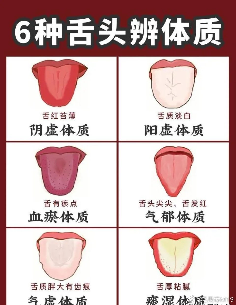 这6种体质的舌苔有什么不同。人的体质可以分为气虚质、阳虚质、阴虚质、痰湿质、血瘀