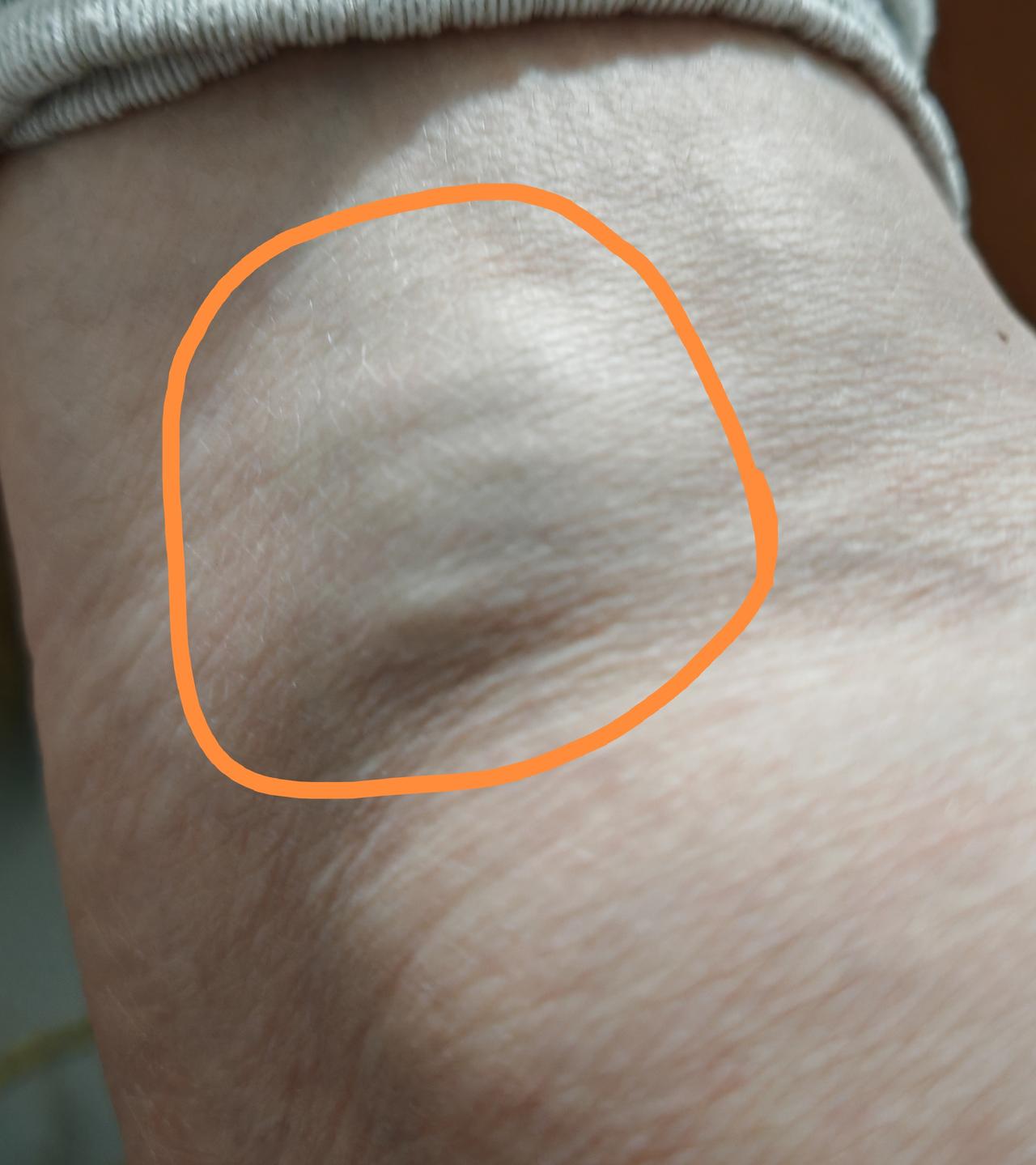 今天真的很惨，同一个地方摔下来两次，第一次毫发无伤，第二次一言难尽。
真的好想哭