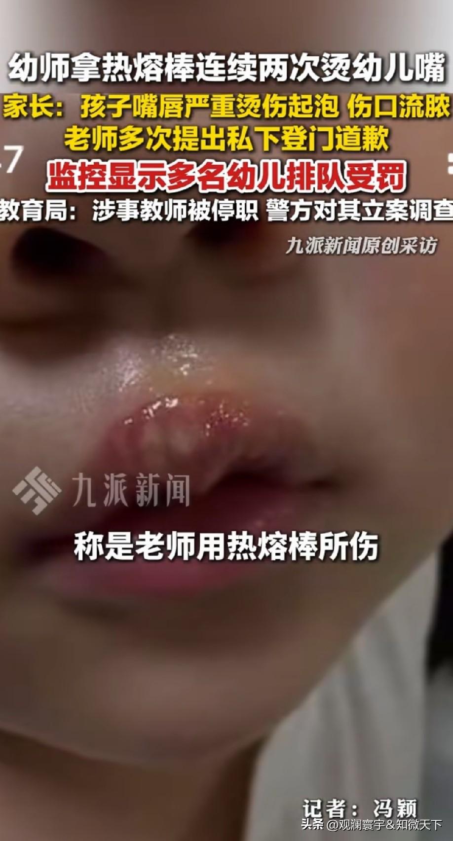 必须抓起来严惩[发怒]，
这是一个老师能做出来的？
这么的人也能成为老师？
孩子