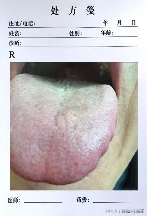 情欲看似很强烈，耕地不如老黄牛，气喘无力，瞬间疲软！

患者主诉：宗筋疲软无力，