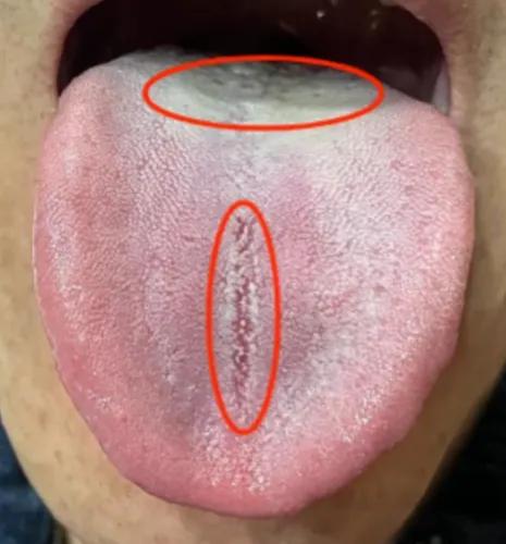 这位大哥说他肾虚，但是为啥吃金匮肾气芄没啥效果？接着往下看
 
大哥说他平时觉得