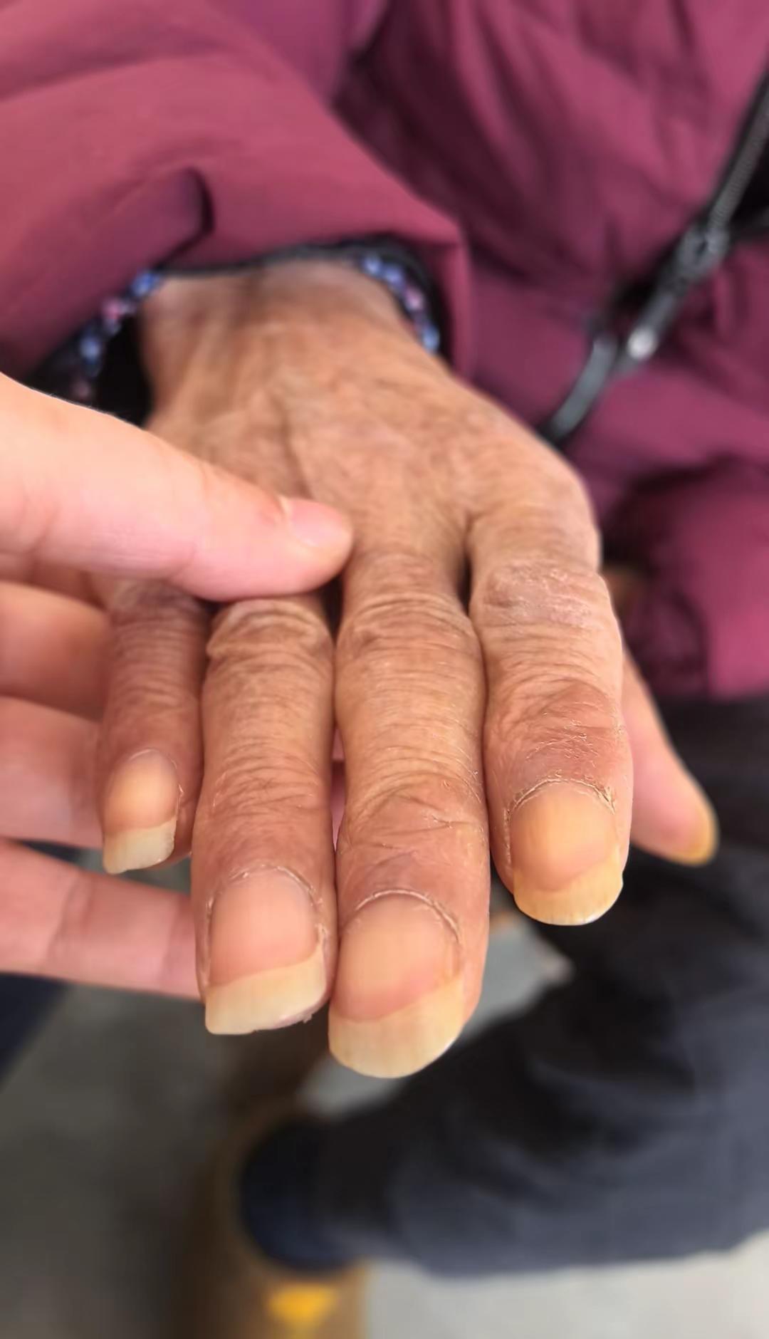 关爱残疾人让世界充满爱