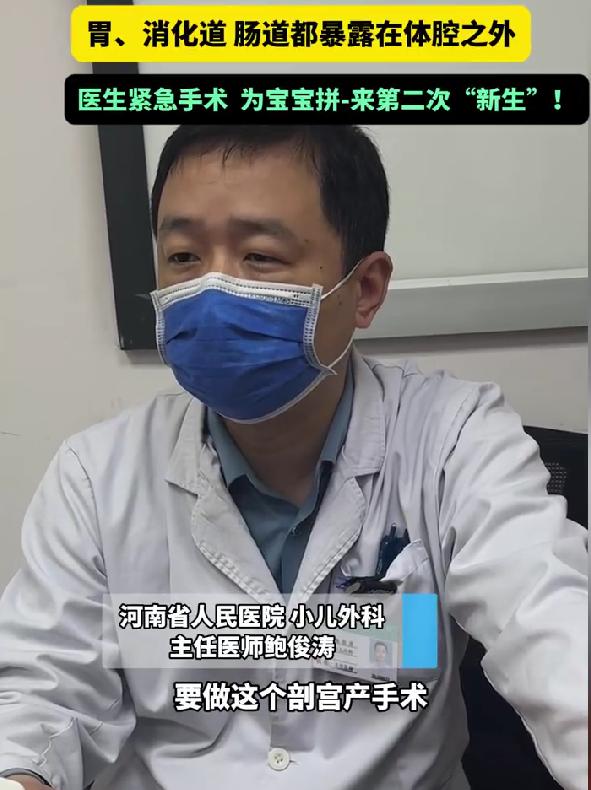 婴儿肚皮开裂多器官裸露，多科室极限接力，手术圆满成功
近日，河南一则新生儿急诊消