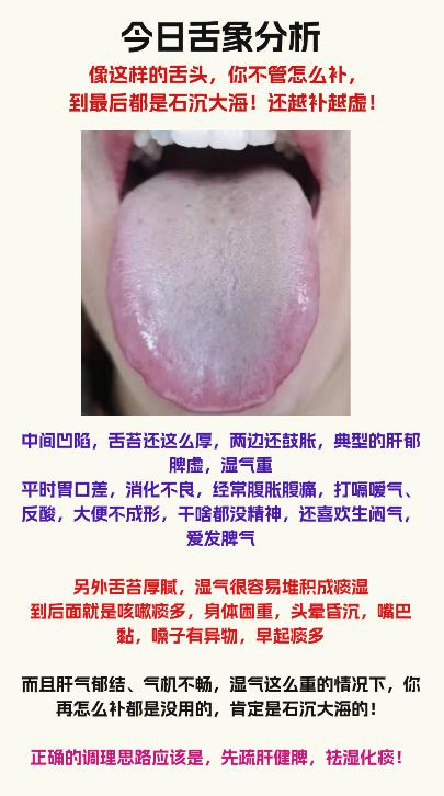 出现这种舌象，不要直接进补，补再多都无用