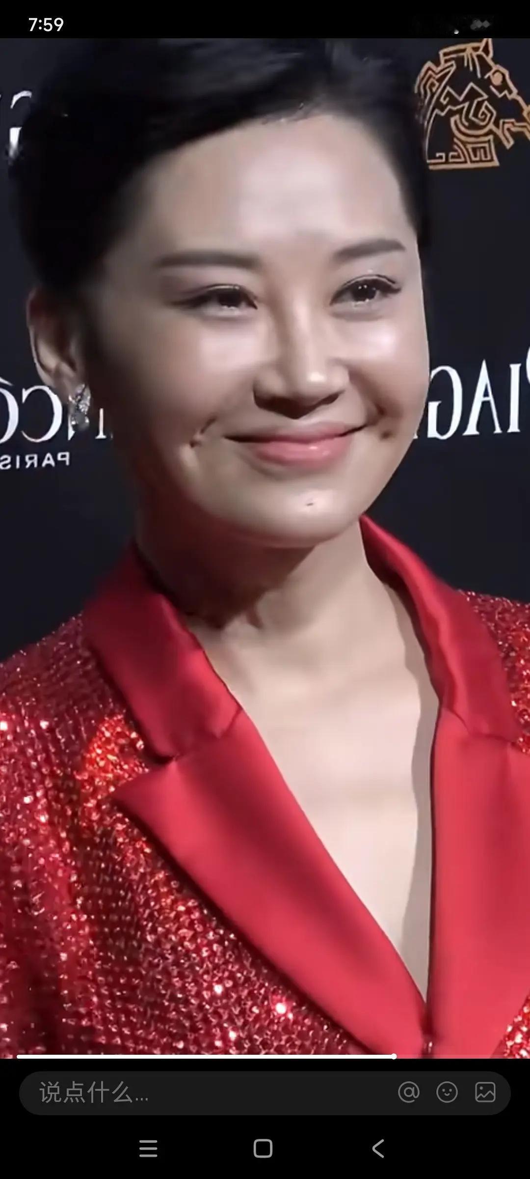 第一眼没看出来是谁，第二眼才看出来这是许晴。

好家伙，这是往脸上注射了什么物质