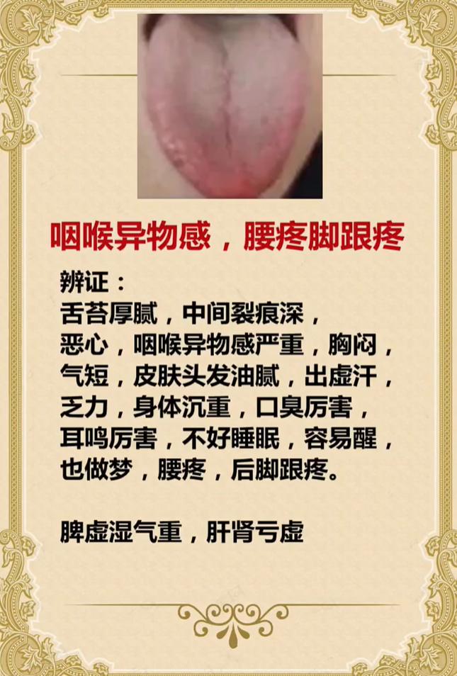 咽喉异物感 + 腰疼脚跟疼？多半是脾虚湿气重、肝肾亏虚了
