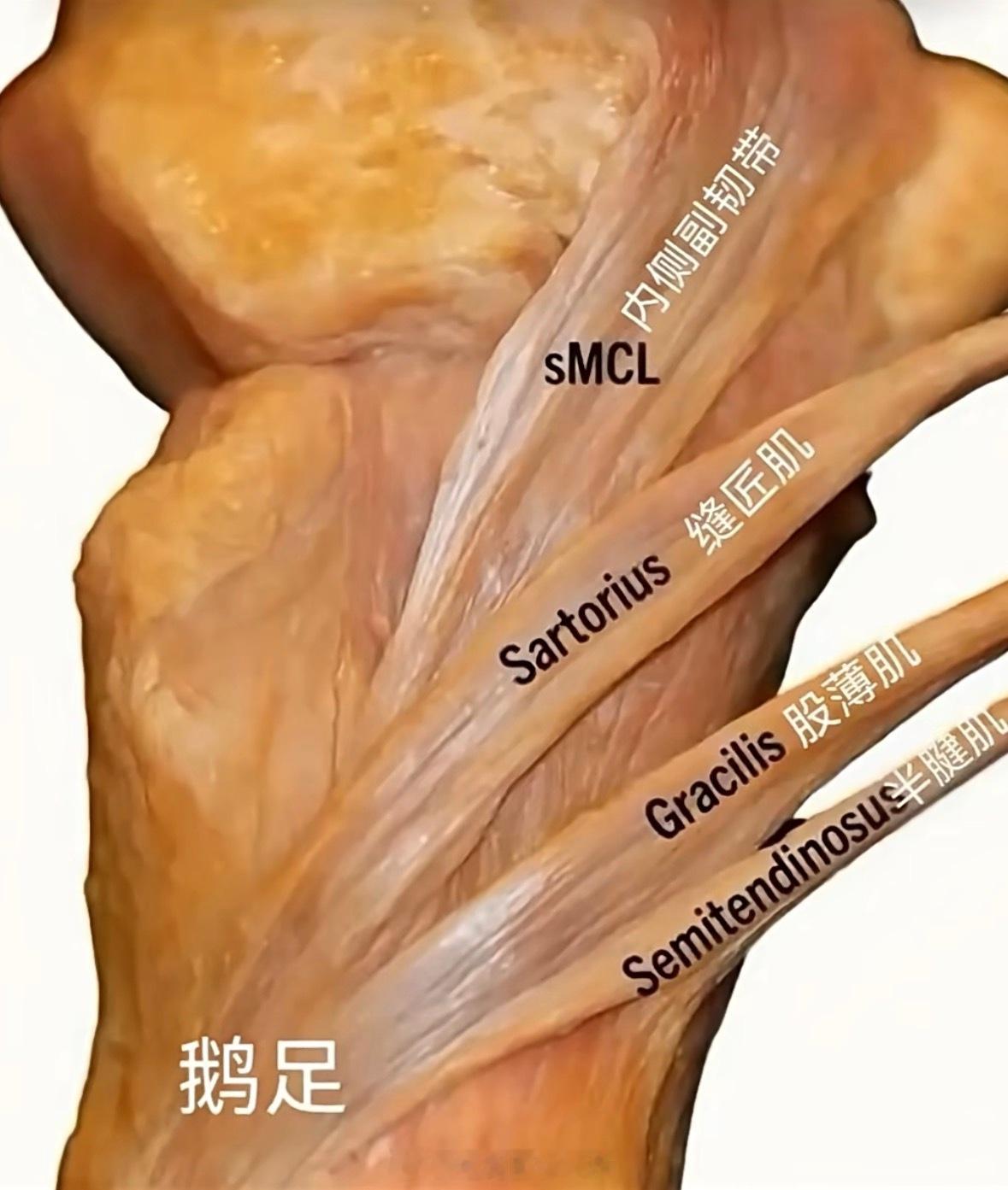 鹅掌区的三条肌腱与内侧副韧带。 ​​​