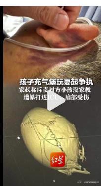 骂对方小孩没家教遭暴打男子发声 【孩子玩耍起争执家长遭殴打进ICU 目前警方已刑