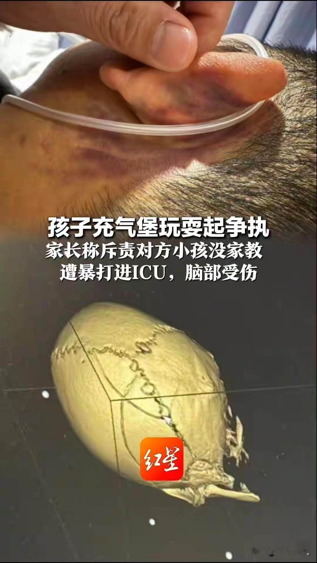 “溺爱出莽夫，护短出恶人”贵州，男子带着孩子在充气堡玩耍，期间，孩子被一陌生小孩
