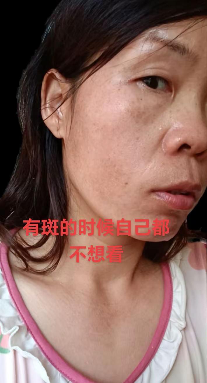 已有好多朋友跟我说，我的皮肤变好了，是的，因为我一直坚持，而不是如他人所说用几天