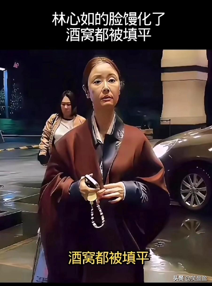 林心如的脸蛮化了，
酒窝都被填平。
别急着嘲讽，这恰恰捅破了所有中年女人的一个残