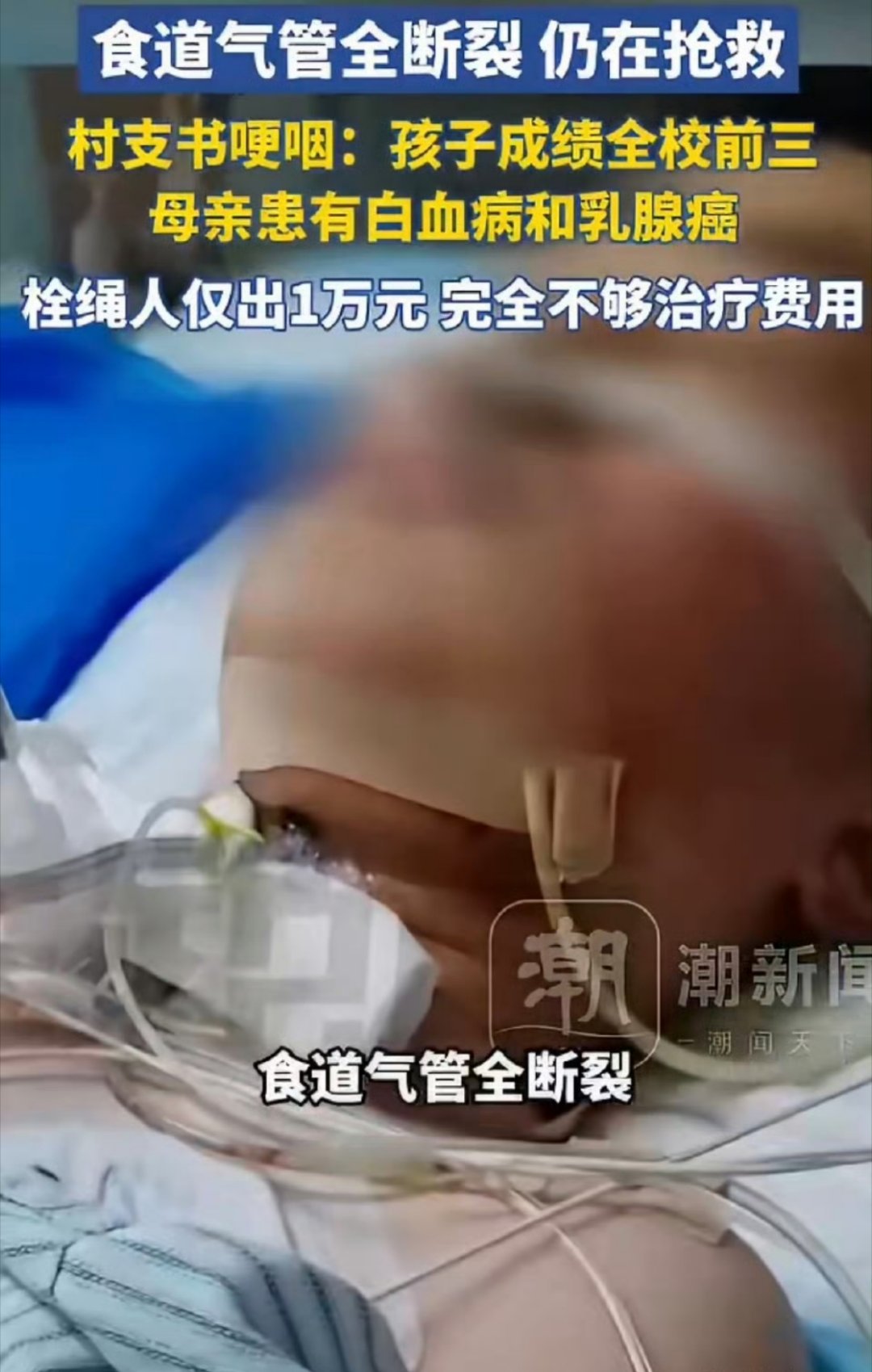 老人私栓绳子致男孩气管全断裂恐怖故事……厄运专挑苦命人👮🏻♂️不管吗 