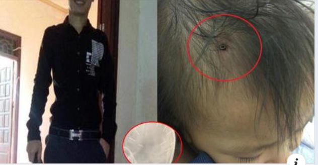 心狠手辣！越南一男子将9颗钉子扎进继女脑袋，此前多次殴打继女