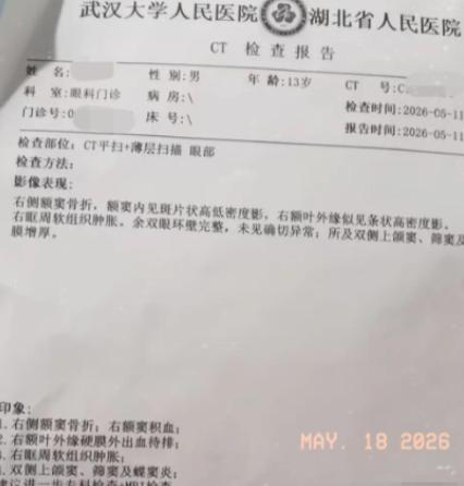 灭绝人性！江西一个13岁男孩，就因为性格叛逆，被父母花3.28万元塞进了一家“成