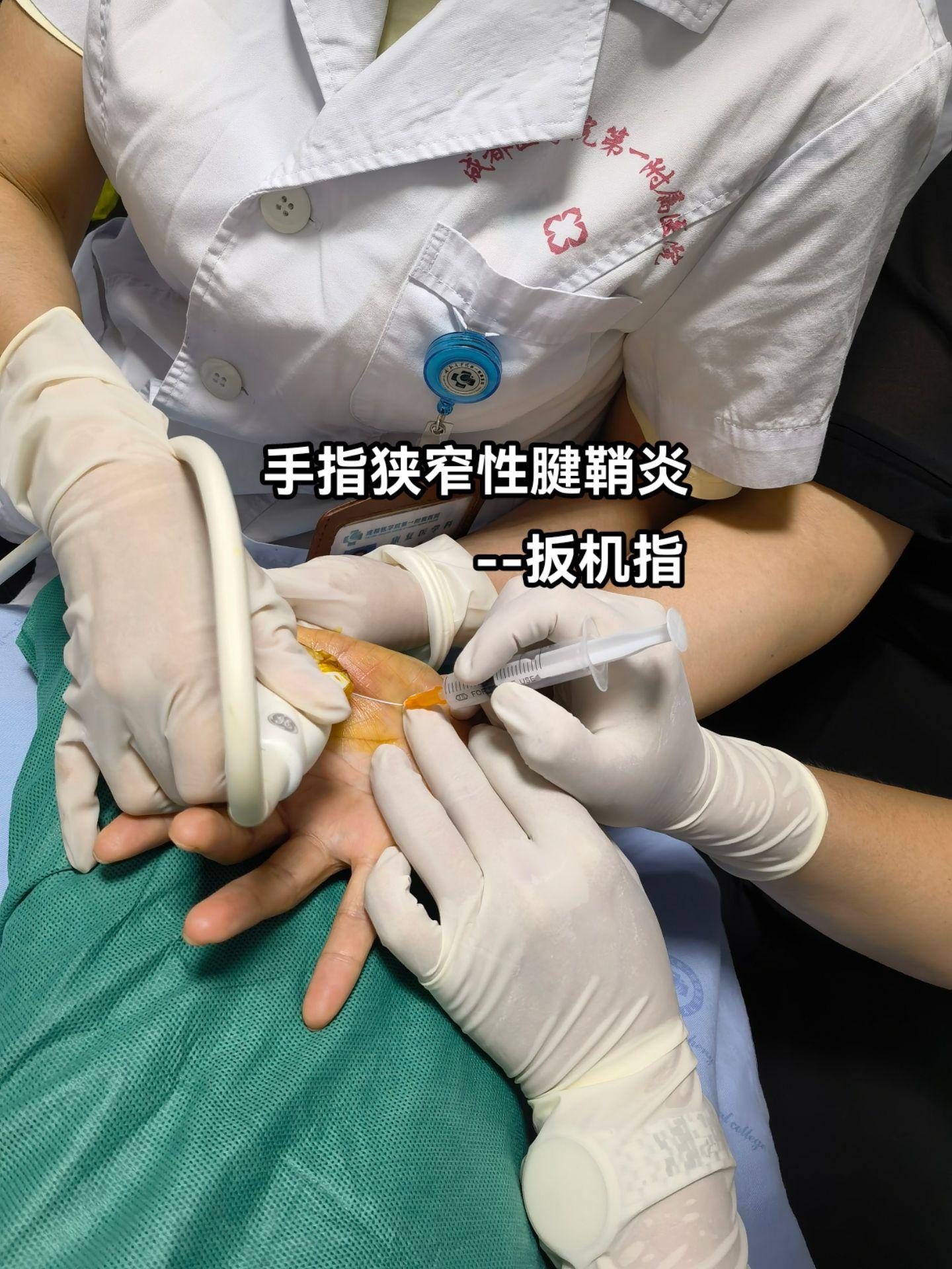 手指疼痛，屈伸受限，卡住感，进展性加重，多发生于中年妇女，为啥？评论区留言。