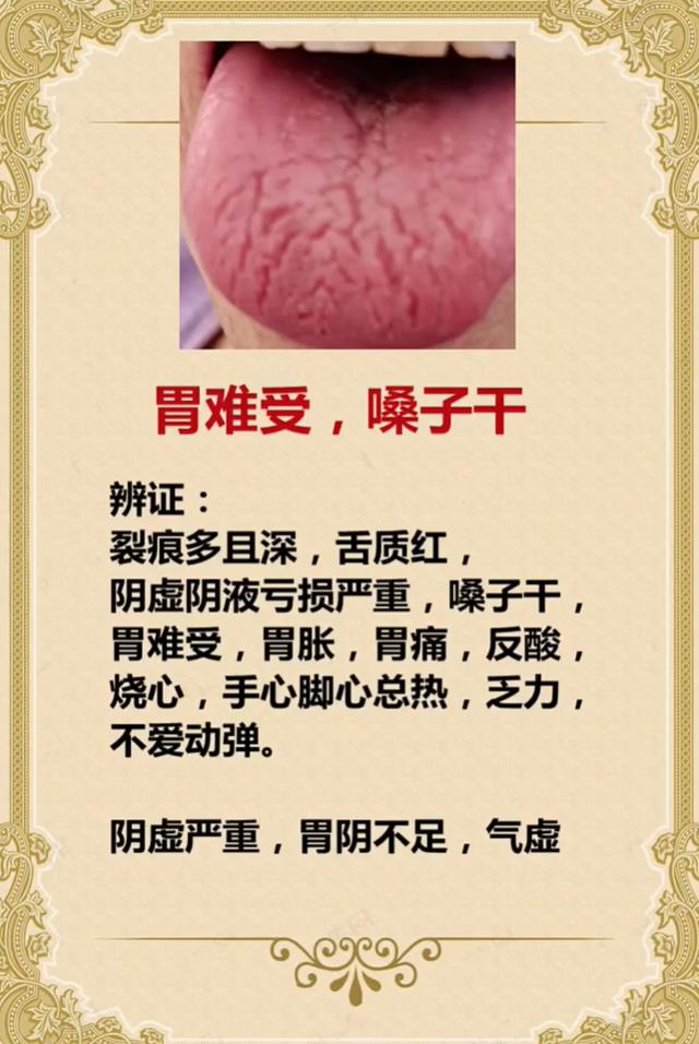 胃难受、嗓子干、手脚心发热？多半是阴虚严重、胃阴不足