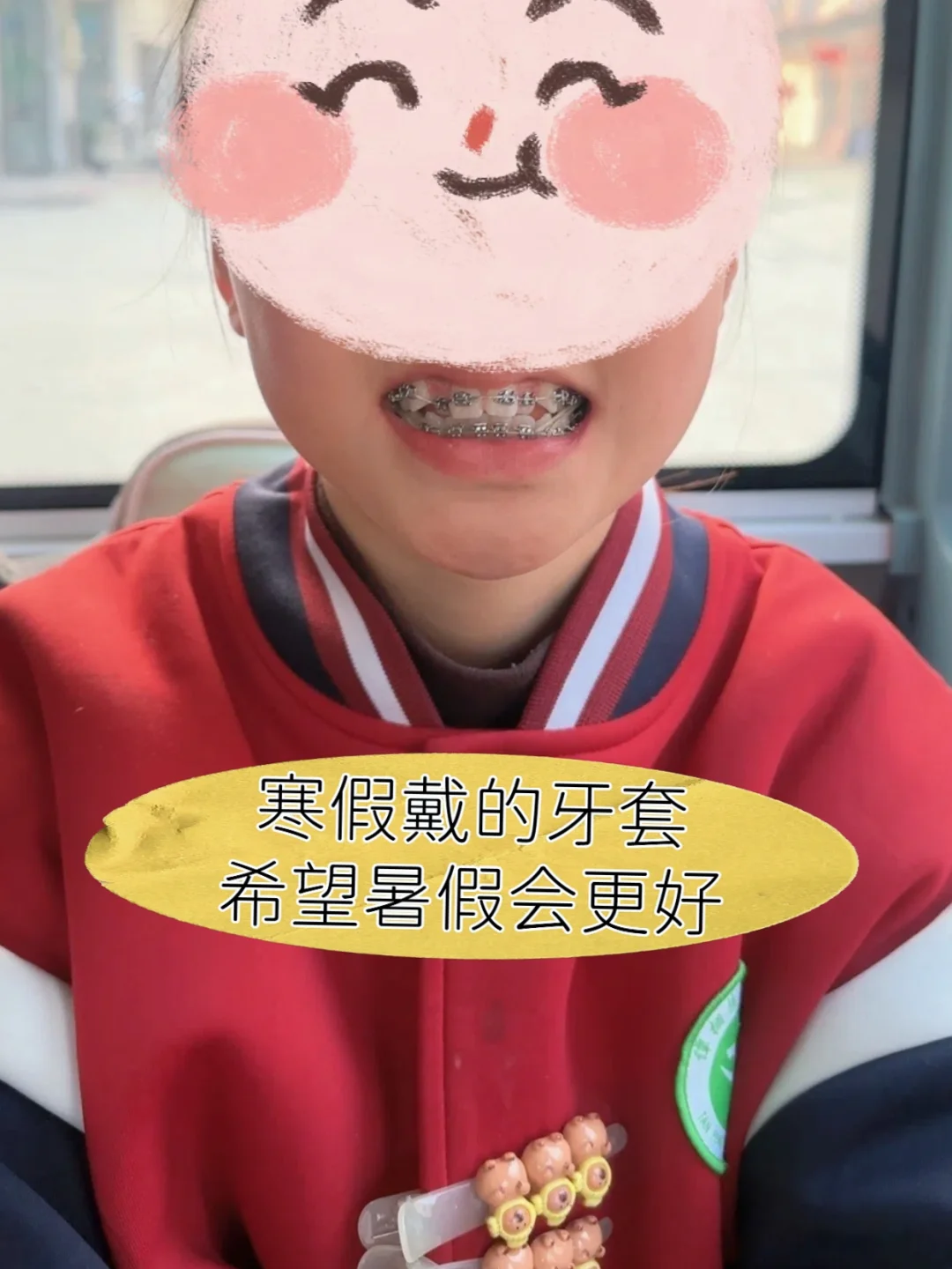 女儿没长齐的牙齿，在东莞找齿科博士整齐