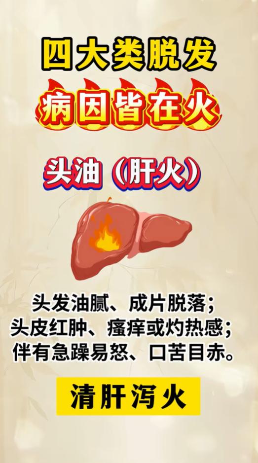 心火、肝火、肾火、胃火，分别对应不同掉发表现