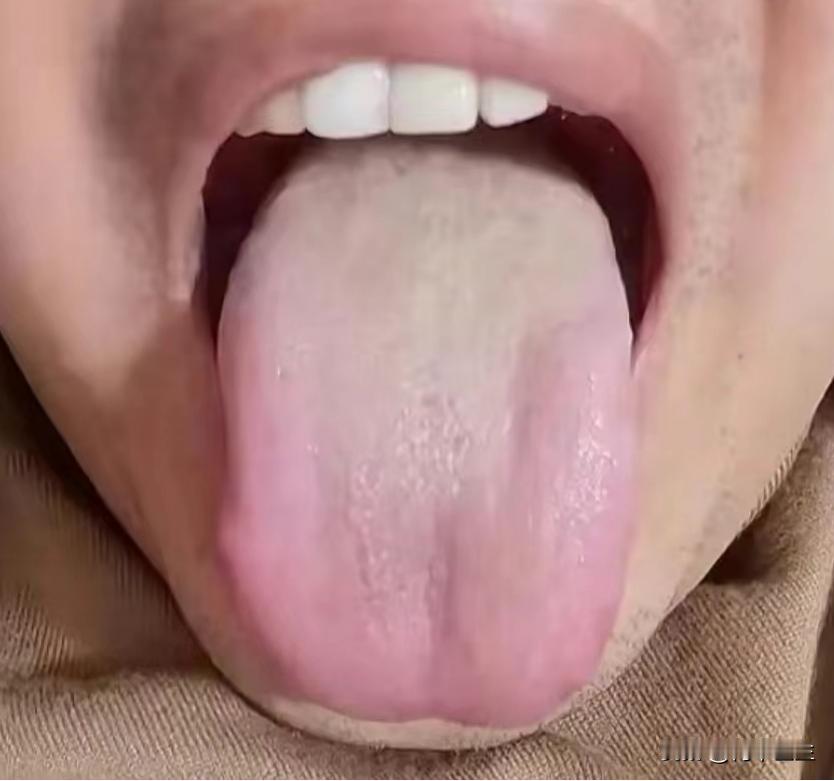 今天看诊一个患者
主诉：腰膝酸软，精神差，有时候还会出现眩晕，欲望低下，倦怠不想