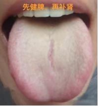 房市差劲，一分钟都难坚持，次次秒，夫妻那方面不和，这些对于不满三十的小伙子来说，