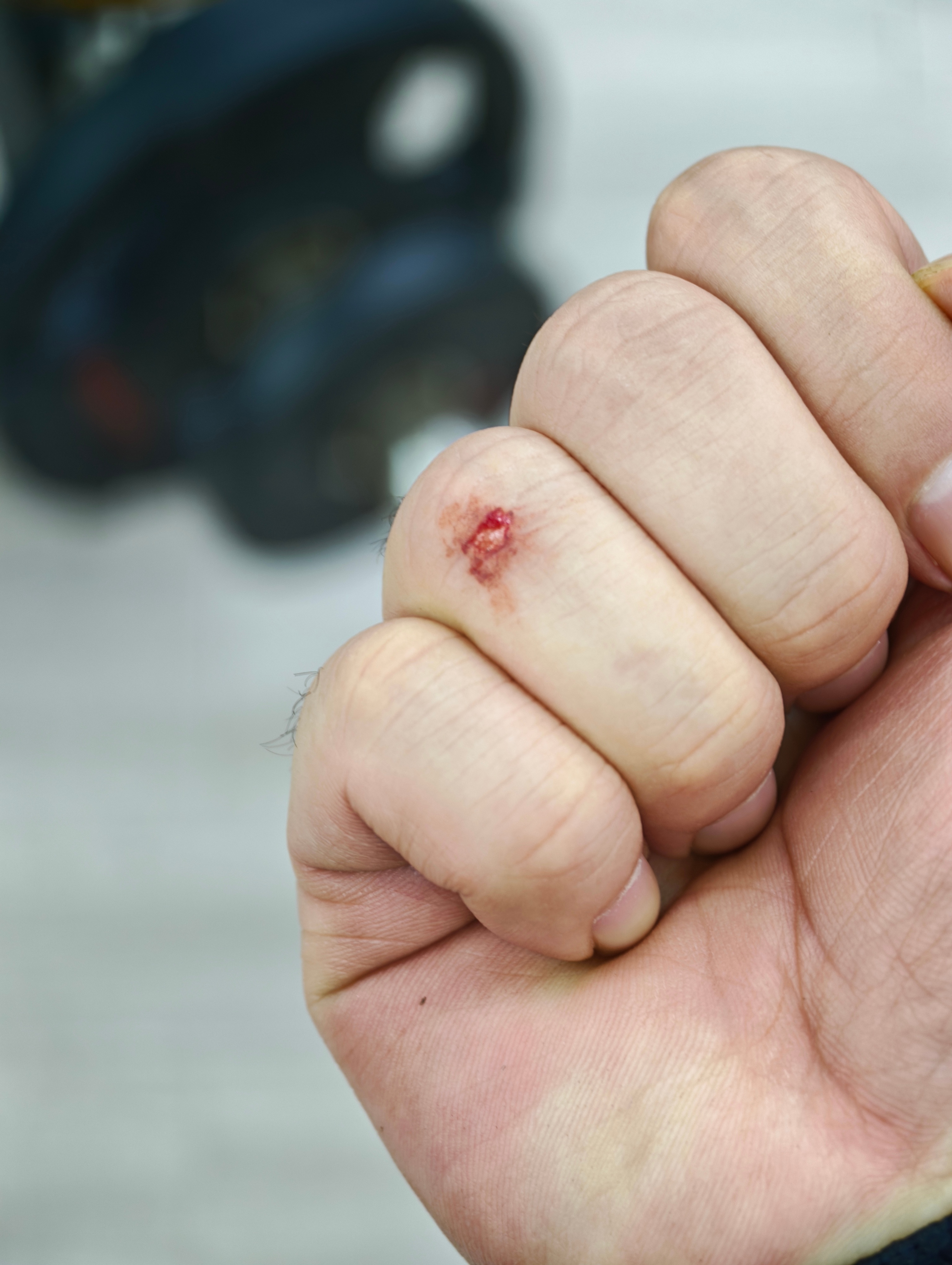 我说怎么越练手指越痛，我练的也不是手指肌肉啊。原来是手指被哑铃片蹭出血来了