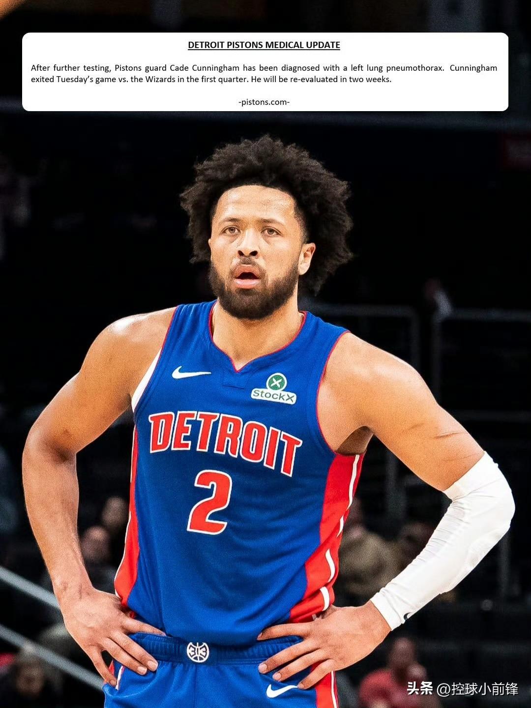 坎宁安的经纪人真的不是脑袋进水了，而且拿人钱财替人消灾，坎宁安越好他就赚的钱越多