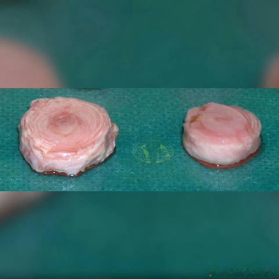 运动康复 来来来，课代表们猜猜看，这是什么？ ​ ​​​