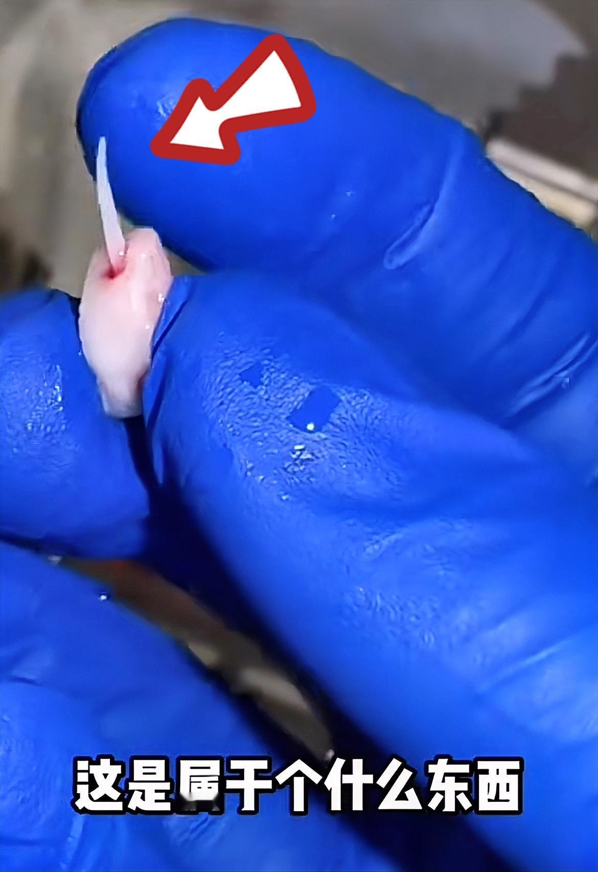 牙疼钻心忍不了，
女子索性狠下心自己动手拔牙！

没想到拔完牙后，
竟发现牙齿里