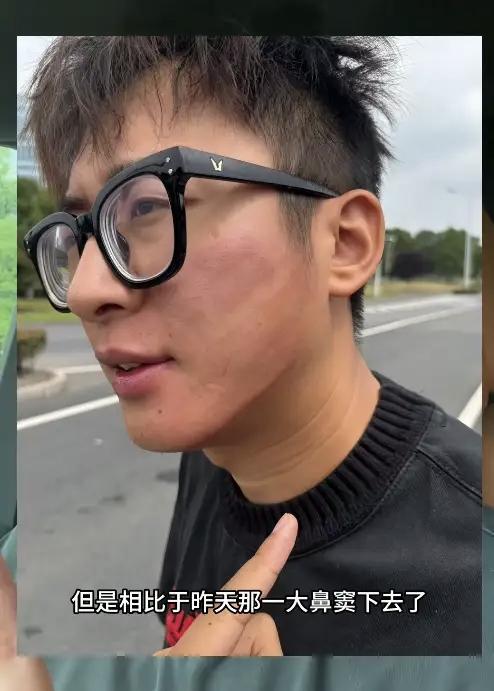 “太嚣张了！”江苏路面发生离谱一幕，小伙正常行车被后车追尾，本来只是普通交通事故