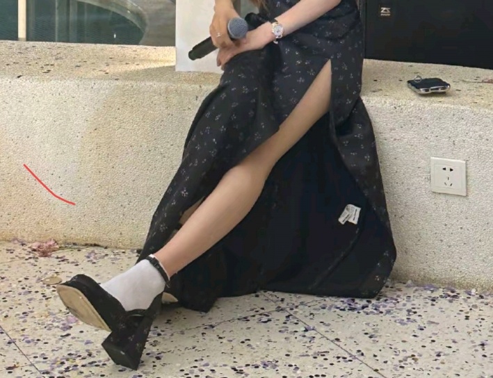 谁来懂一下这个腿呢？ 