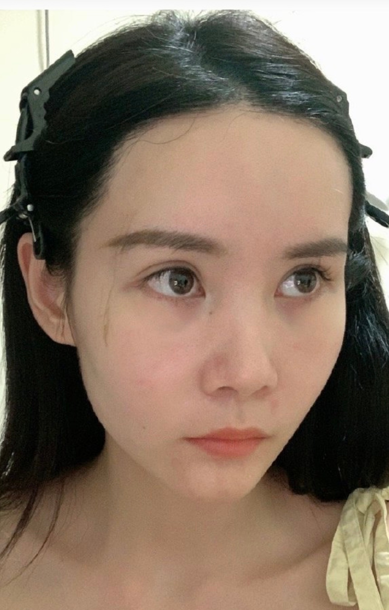 其实这两年额头也变了好多啊 