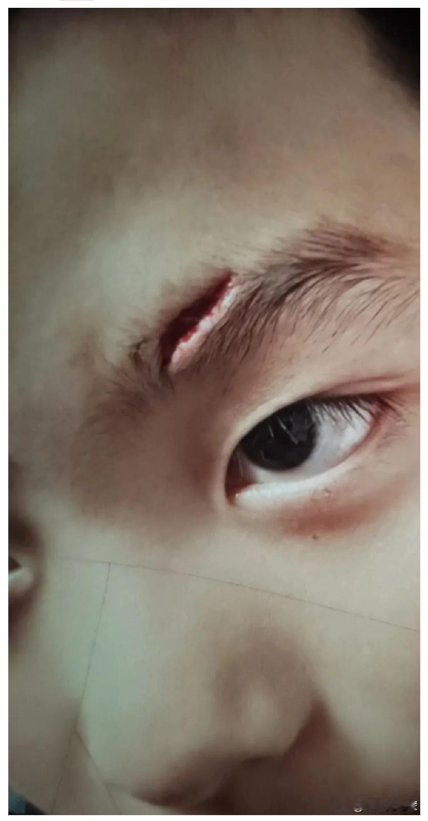 心疼，惹祸了吧？孙子因上学起晚，在屋内磨磨唧唧，被奶奶使劲一推，一下子碰在桌角上