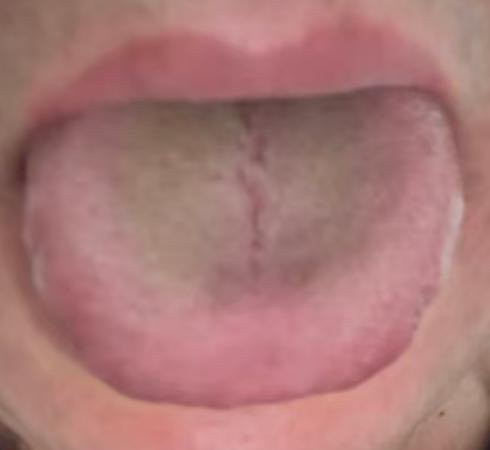 固摄不足、状态不稳别着急，温补脾肾，逐步养回良好状态







说句实在话，