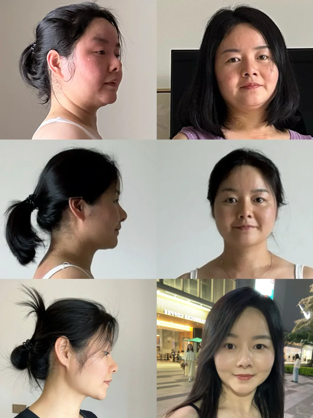 41岁 垮脸自救成功