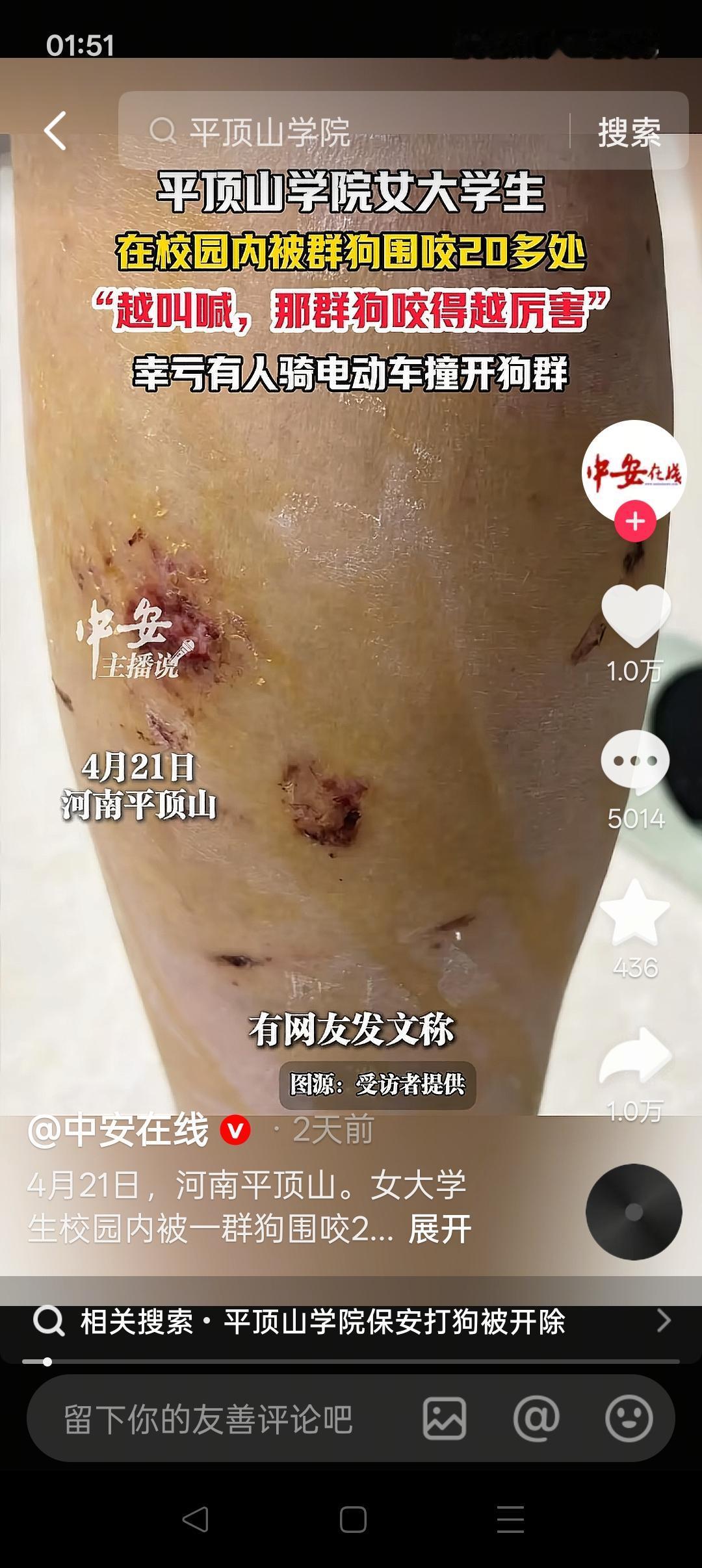 平顶山学院女生被狗群围咬，这只是被迫吞下当年“愚善”种下的恶果而已！
 
202