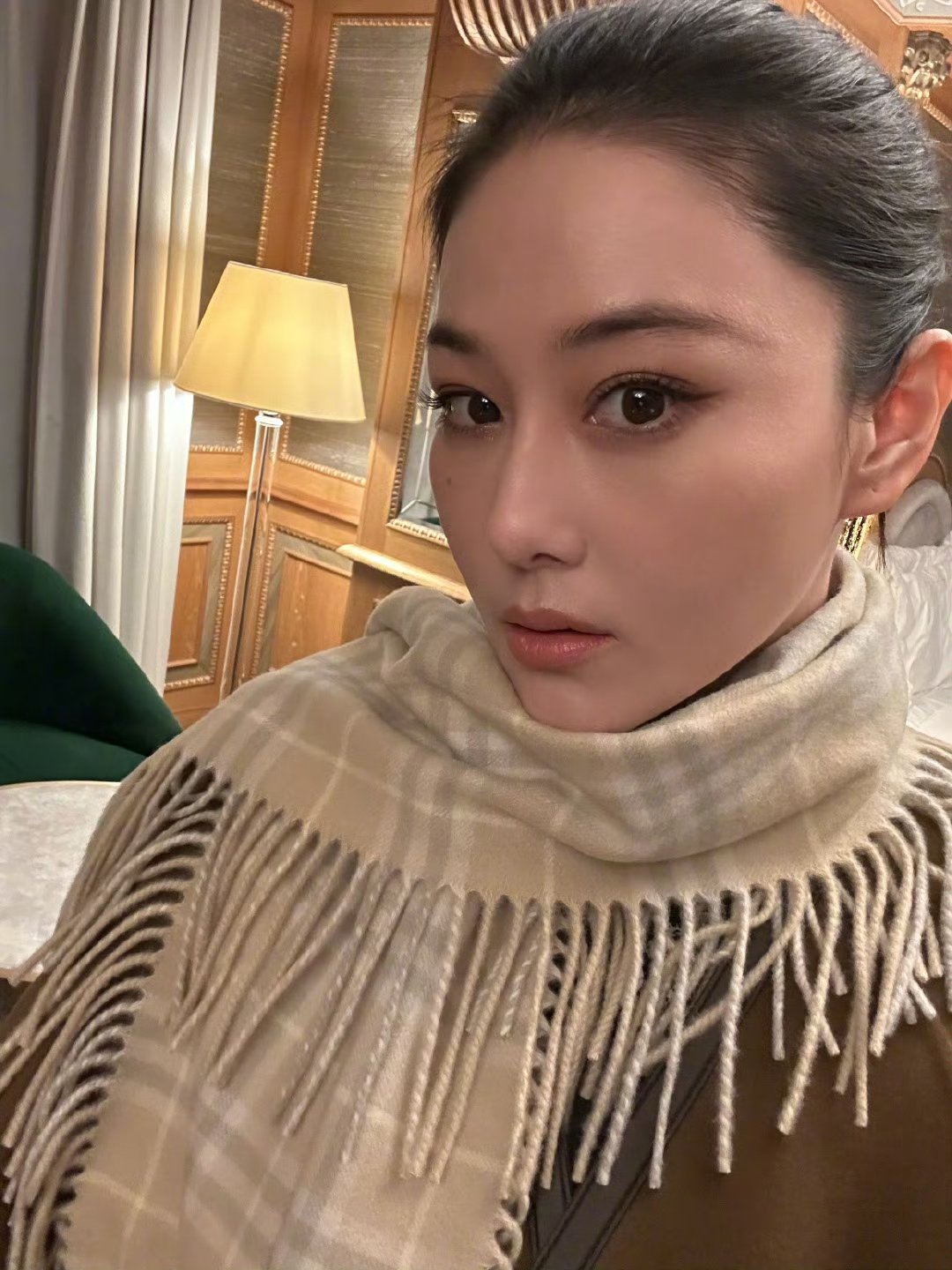 张馨予发际线绒毛 喜欢 张馨予痘痘变痣啊 ​​​