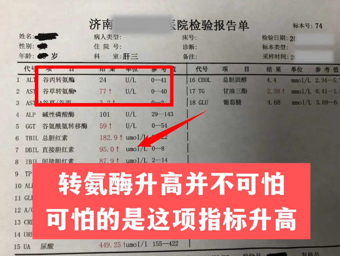 前阵子一位患者查出转氨酶升高，整天担心怀疑自己会不会肝硬化啊，到处寻办...
