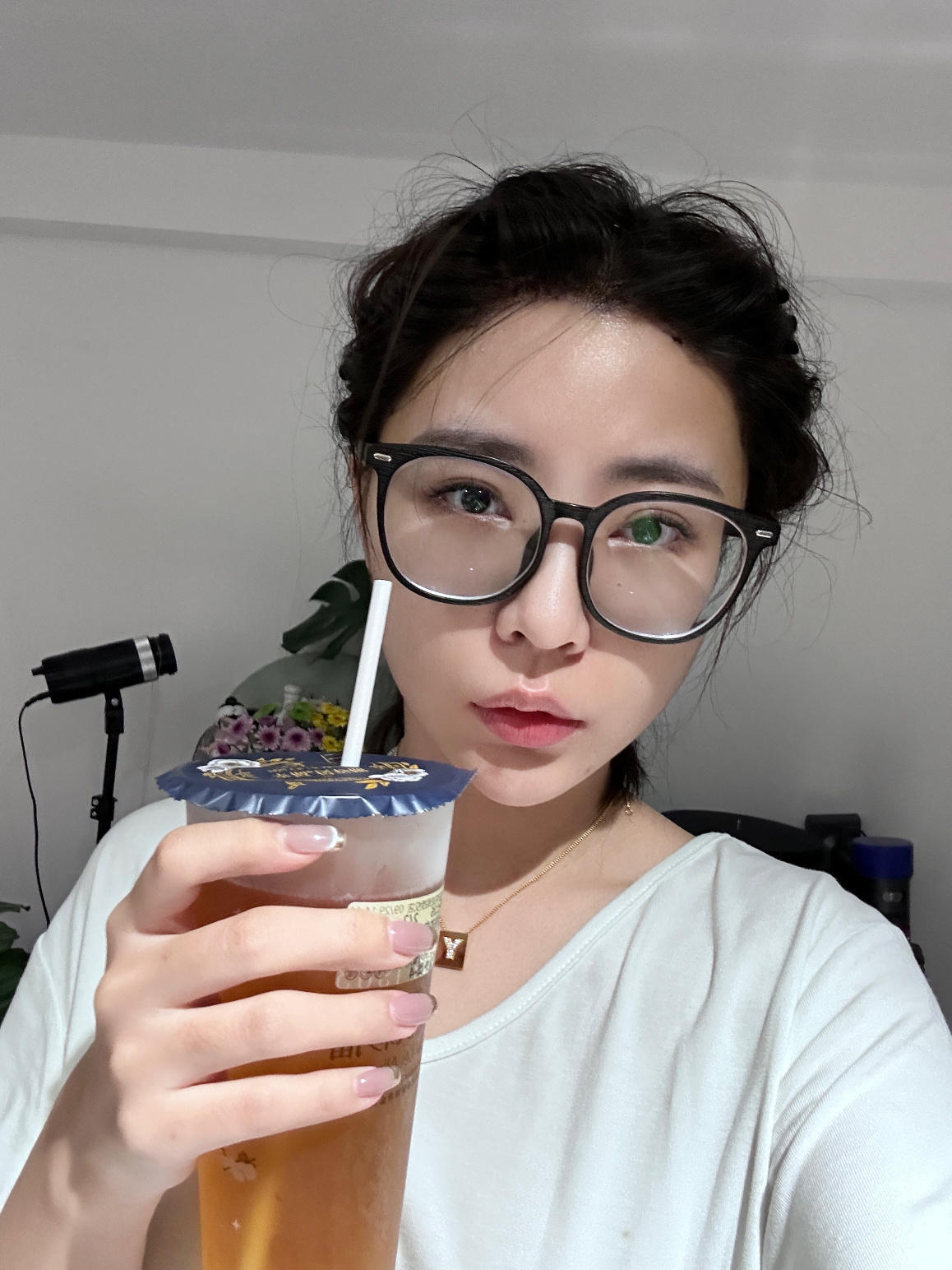 大过节的，肿成蜂蜜狗，昨天整个眼睛都睁不开了。医生说是正常情况，因为额头的肿胀液