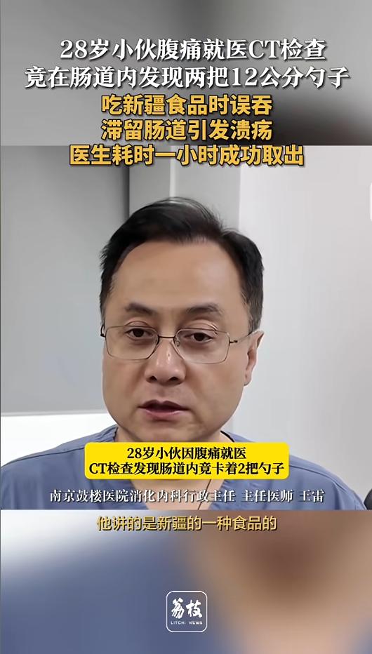 “万万没想到！”近日，江苏南京，一男子因误吞了一把勺子，腹痛难耐到医院就诊。医生