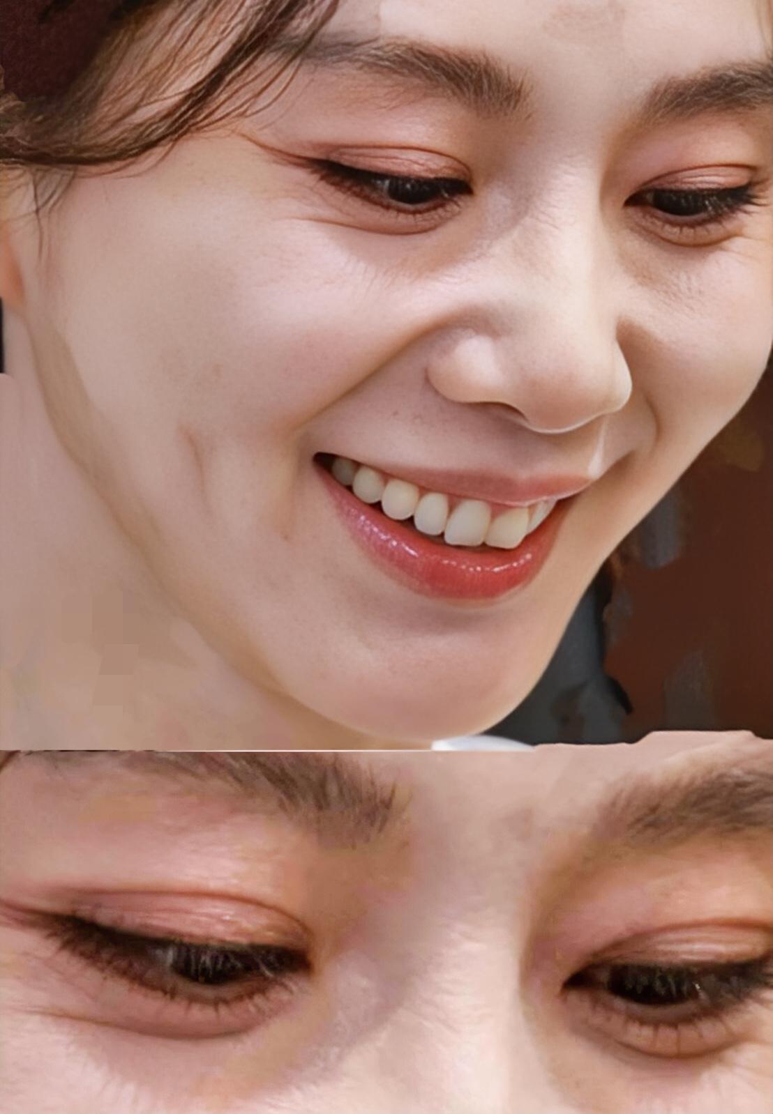 这是贴的啥眼皮贴啊