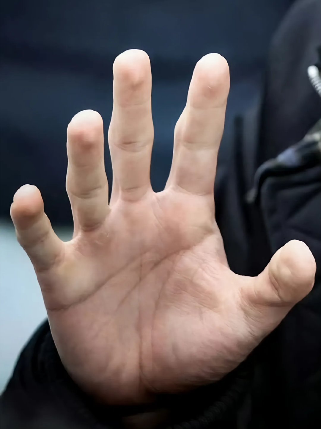 [泪]单单看这双手，便能知晓他有多拼。不要只羡慕眼前的光环，别忘了他一路走来的艰