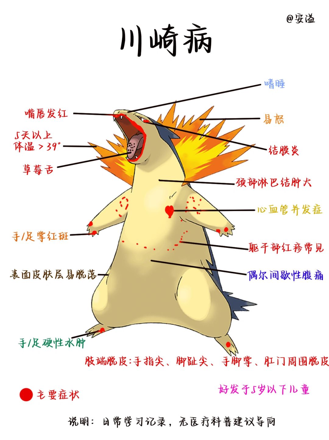 医学生绘本笔记‖川崎病