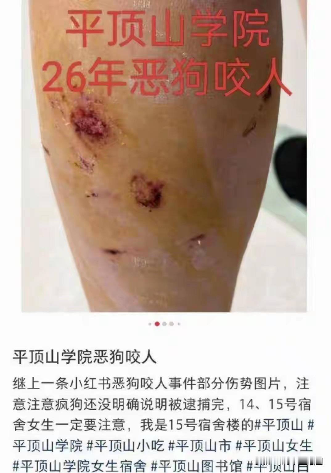 平顶山学院一名女学生夜里校内走路被群狗咬伤，竟有人骂她自作自受。

河南平顶山学