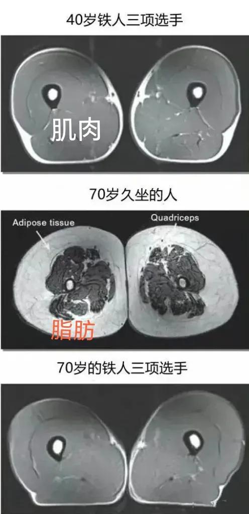 注意！[发怒]
老年人，要适度运动！

这张图告诉我们，想长寿要练腿，下面为您解