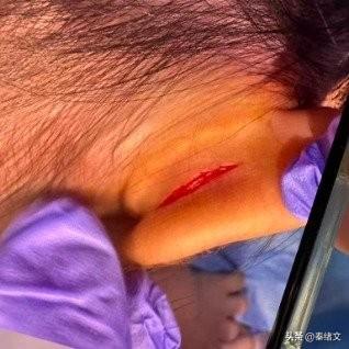 武汉10万高端托班出大事！女童耳朵撕裂3厘米，关键监控竟“坏了”
 
武汉家长邓