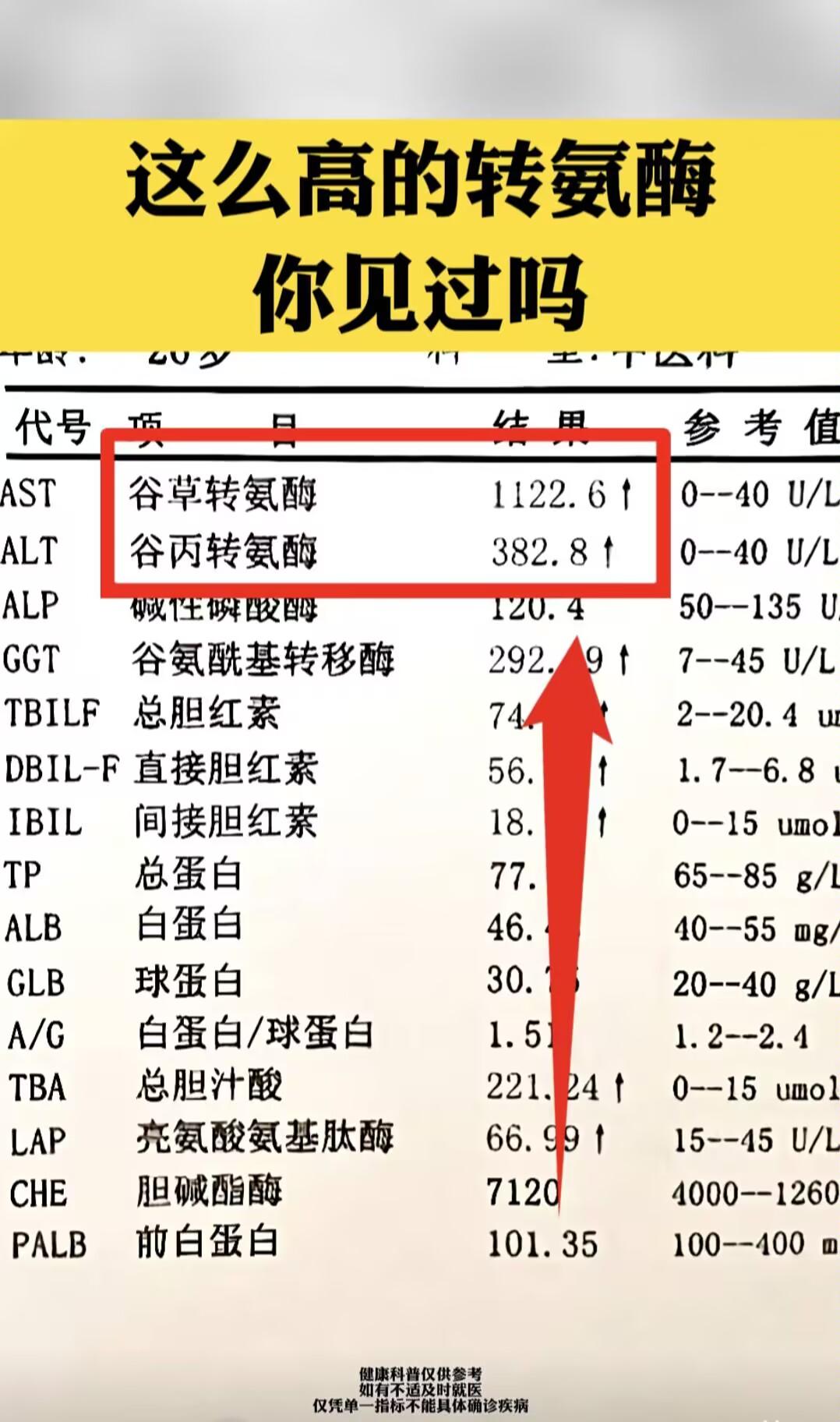 “医生，转氨酶1000多，这正常吗？”我的一位患者拿着化验单给我看，转...