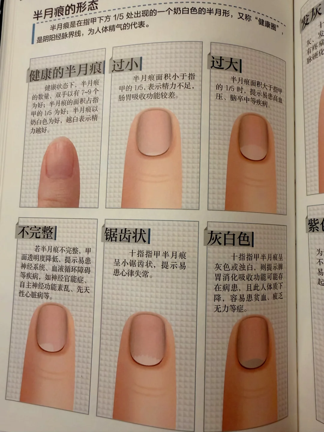 半月痕也叫小太阳