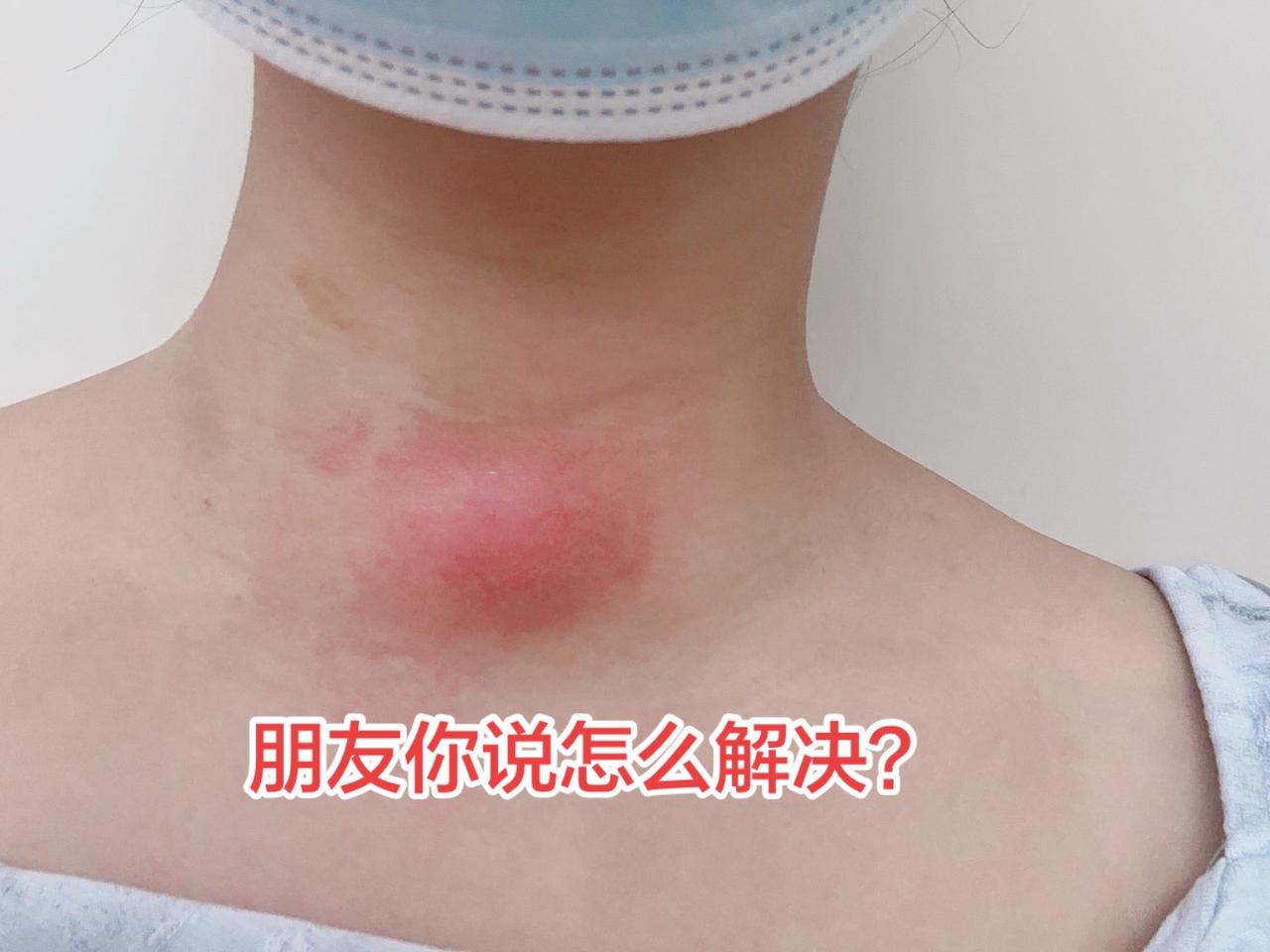 我的承受能力已经到极限了

生病